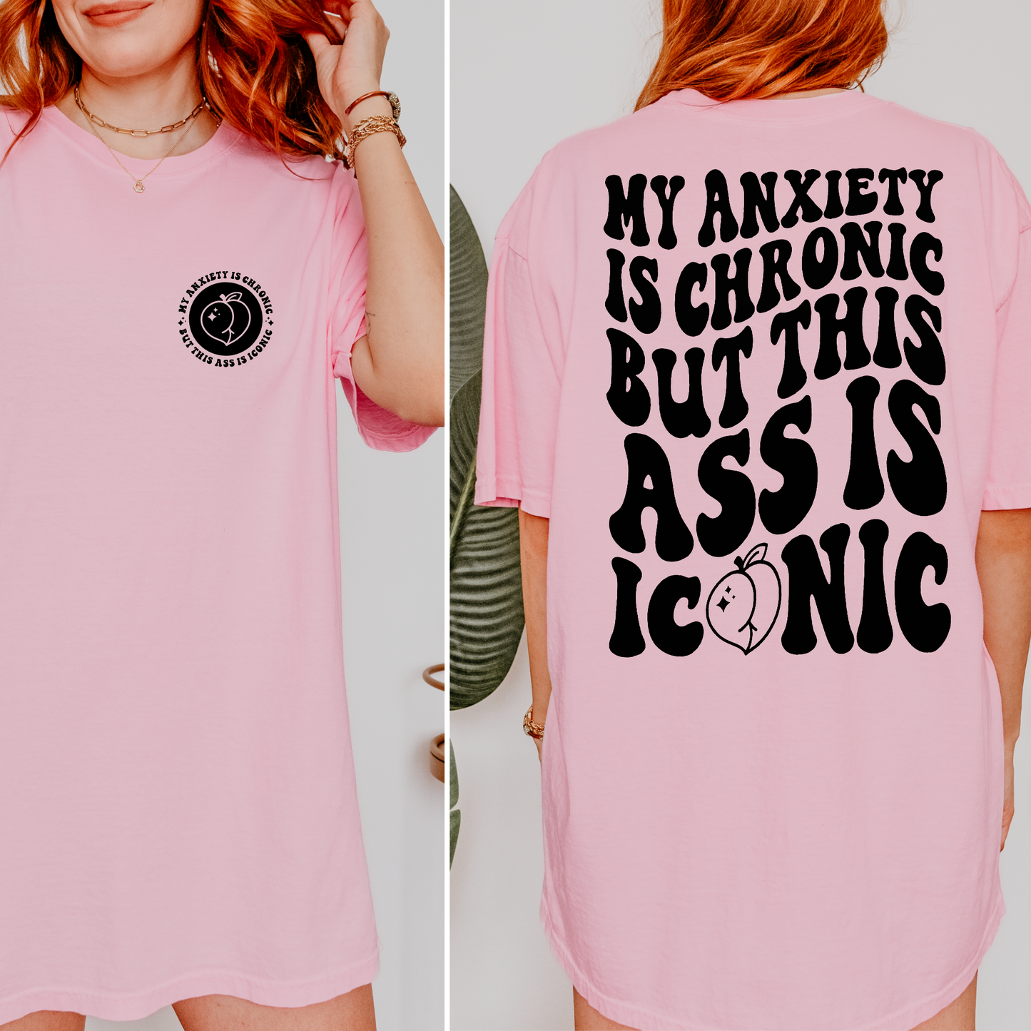 My Anxiety Is Chronic But This Ass Is Iconic Shirt